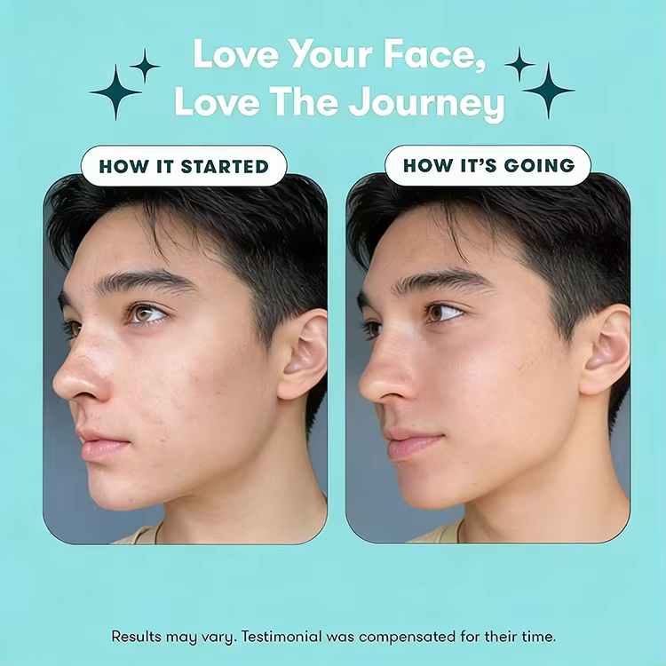 OEM Acne Treatment for Teenage Boys Sensitive Skin Rescue Kit Face Wash,Toner and Moisturizer to Help Clear Pores Reduces Acne