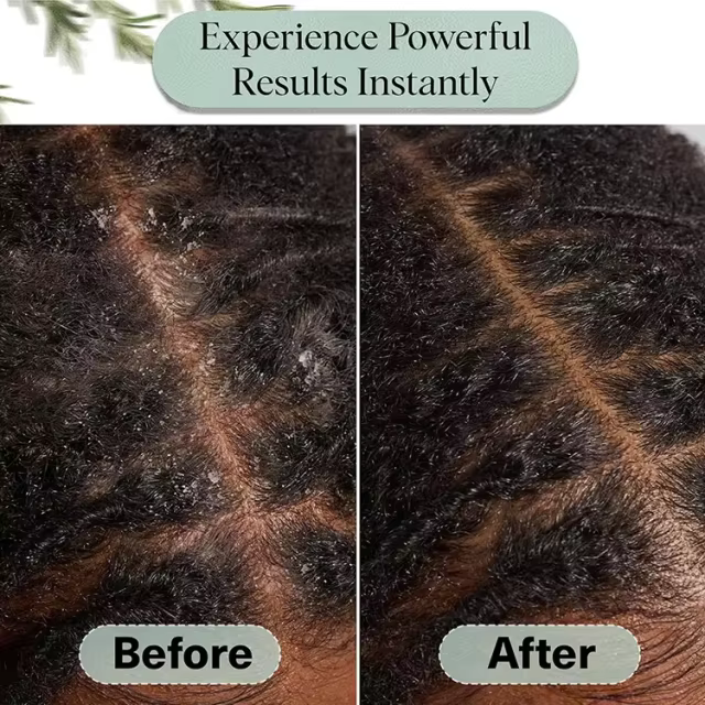 OEM Natural Pre-Wash Scalp Oil & Hair Growth Serum Pre Shampoo Dry Scalp Treatment Nourishing Repair Oil for All Hair Types