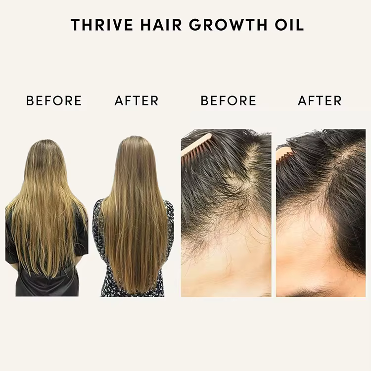 FDA/GMP Facility Natural Hair Repair Oil with Castor Rosemary Oil Effective Thickening Hair Growth Serum
