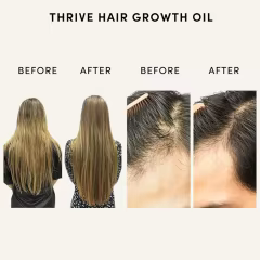 FDA/GMP Facility Natural Hair Repair Oil with Castor Rosemary Oil Effective Thickening Hair Growth Serum