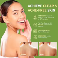 Custom Label Antifungal Tea Tree Soap Antibacterial Treatment for Face & Body Acne Herbal Soap Bar for Skin Soothing&Hydration