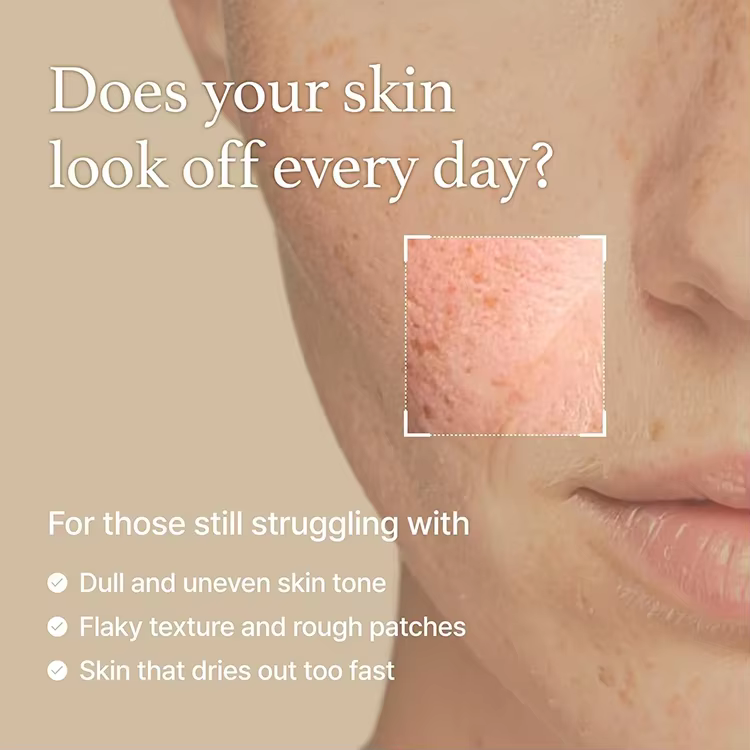 Custom Label Rice Glow Milky Toner with Niacin-amide Ceramide for Glowing Skin Non Comedogenic, Fungal Acne Safe Rice Water