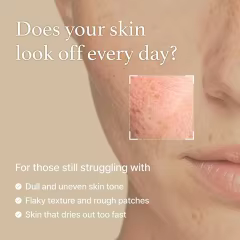Custom Label Rice Glow Milky Toner with Niacin-amide Ceramide for Glowing Skin Non Comedogenic, Fungal Acne Safe Rice Water