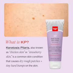 OEM KP Bump Eraser Body Scrub Mask for Keratosis Pilaris Skin Care Exfoliator Shower Scrub & Exfoliator for Sensitive Skin