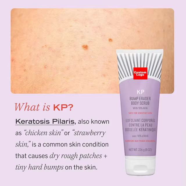 OEM KP Bump Eraser Body Scrub Mask for Keratosis Pilaris Skin Care Exfoliator Shower Scrub & Exfoliator for Sensitive Skin