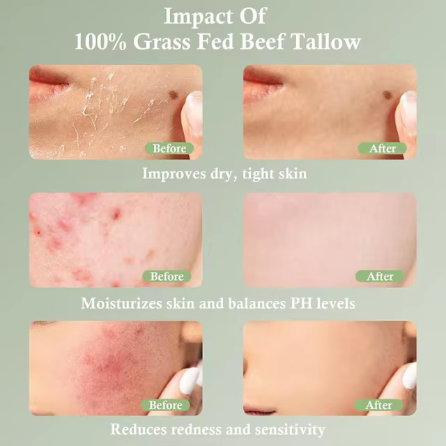 FDA Certified Moisturizer Manufacturer Organic Grass-Fed Whipped Beef Tallow and Honey Balm for Dry Face Body Hands