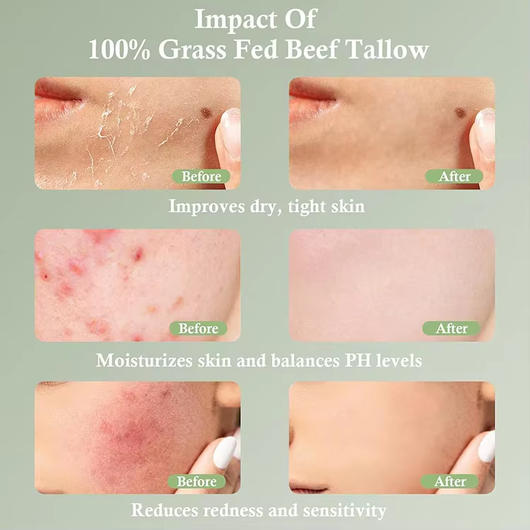 FDA Certified Skincare Products Private Label Honey Balm Moisturizer Vanilla Essential Oil Natural Grass Fed Beef Tallow