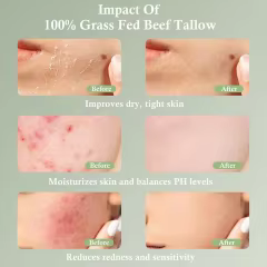 FDA Certified Skincare Products Private Label Honey Balm Moisturizer Vanilla Essential Oil Natural Grass Fed Beef Tallow