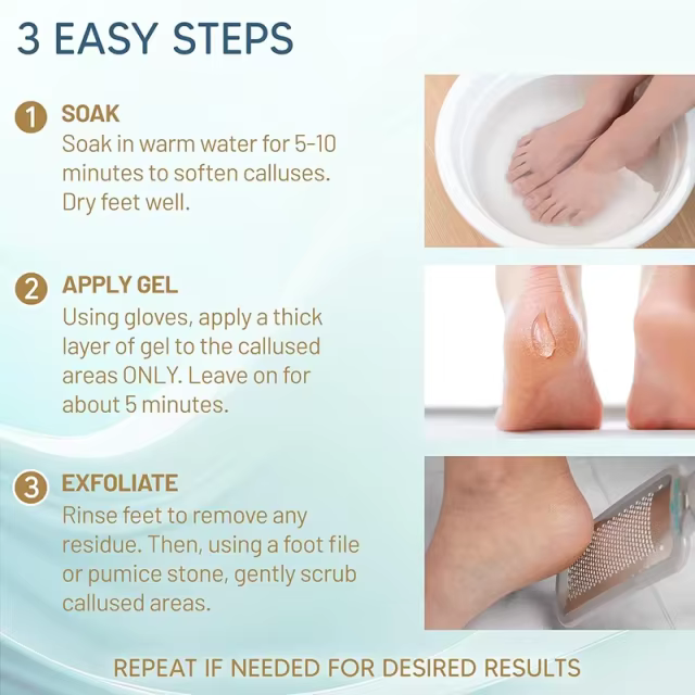 Custom Callus Remover Gel for Feet, Extra Strength Dead Skin Scrubber, Pedicure Tools Supplies, Foot Care Spa Kit