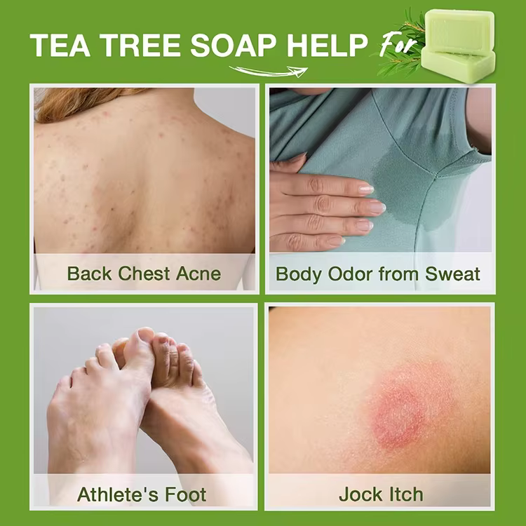 GMP Factory OEM Antifungal Antibacterial Soap Bar with Natural Tea Tree Oil Fights Body Odor,Soothes Jock Itch & Athlete's Foot