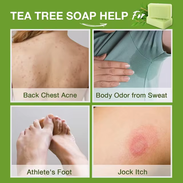 GMP Factory OEM Antifungal Antibacterial Soap Bar with Natural Tea Tree Oil Fights Body Odor,Soothes Jock Itch & Athlete's Foot