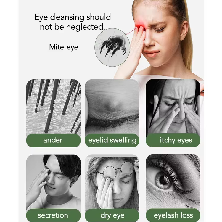 Custom Private Label Premium Eyelid Cleaning Wipes Individually Wrapped Natural Essentials Allergy Eyelid Cleanser