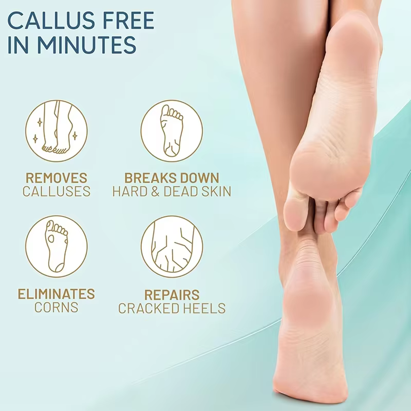 Custom Callus Remover Gel for Feet, Extra Strength Dead Skin Scrubber, Pedicure Tools Supplies, Foot Care Spa Kit