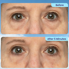 CustomLogo Instant Lift Under Eye Gel, Reduces Puffiness, Bags, Wrinkles, Fine Lines & Dark Circles, Anti-Aging Brightener for Men & Women