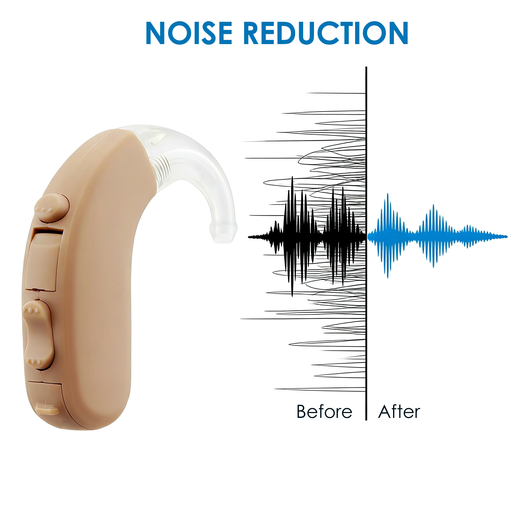 BTE Hearing Aid for Seniors - Behind the Ear Sound Amplifier with MPO & NH Digital Trimmer, Adjustable Volume, Preset Program Mode Switch for Hearing Loss Assist
