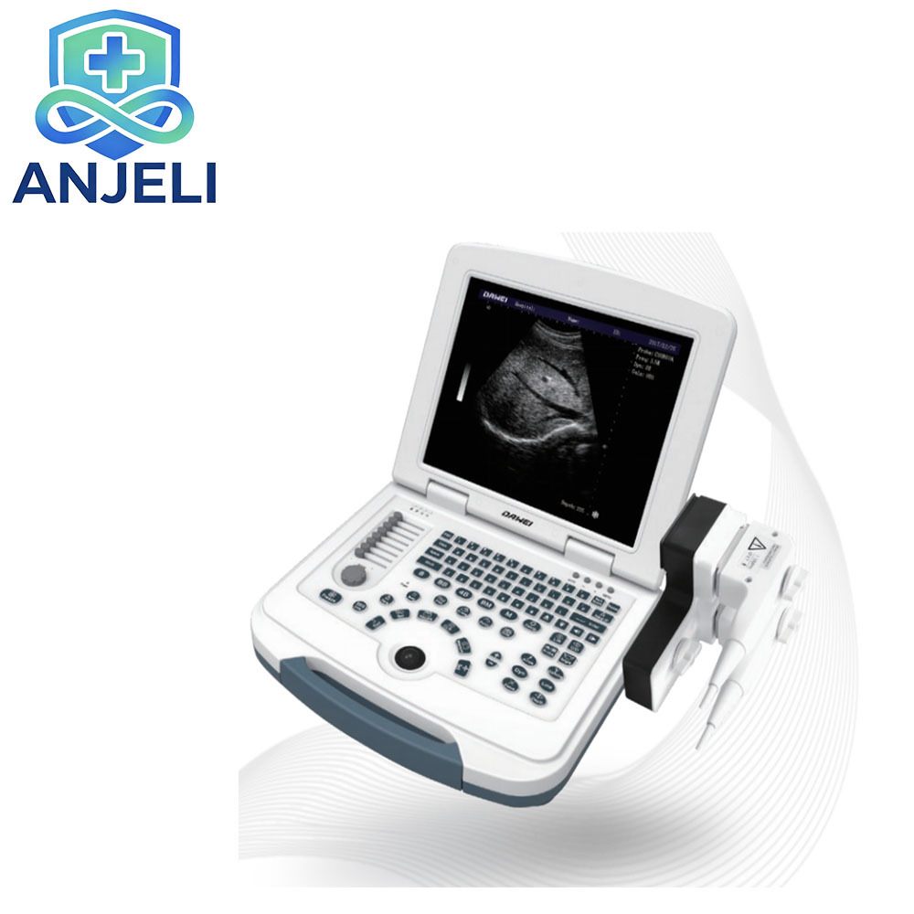 AJL-B580  Medical Laptop B/W Diagnostic Ultrasound Device,AJL-B580  Medical Laptop B/W Diagnostic Ultrasound Device