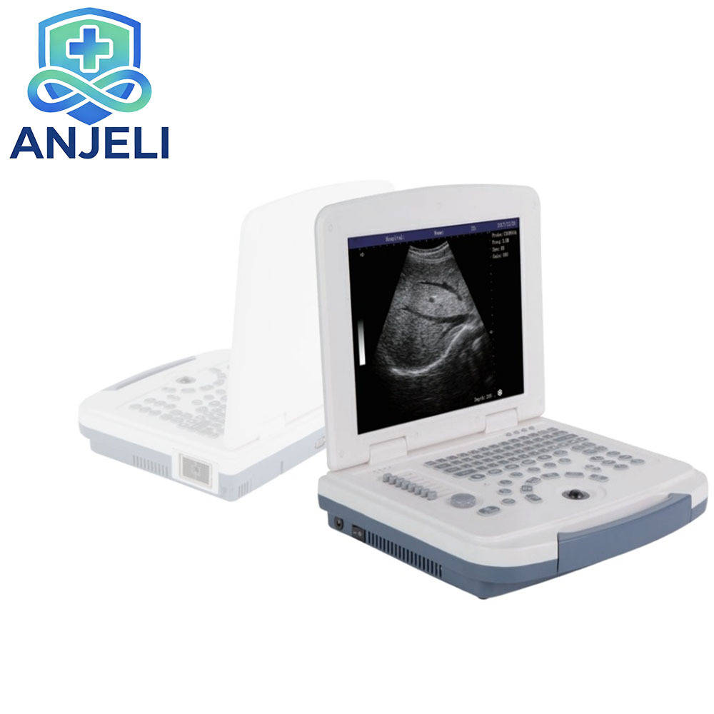 AJL-B580  Medical Laptop B/W Diagnostic Ultrasound Device,AJL-B580  Medical Laptop B/W Diagnostic Ultrasound Device