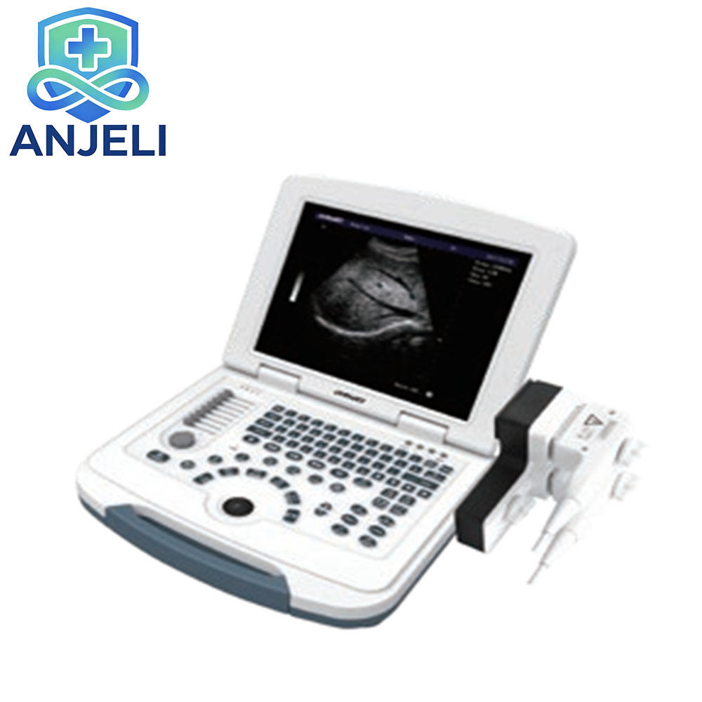 AJL-B580  Medical Laptop B/W Diagnostic Ultrasound Device,AJL-B580  Medical Laptop B/W Diagnostic Ultrasound Device