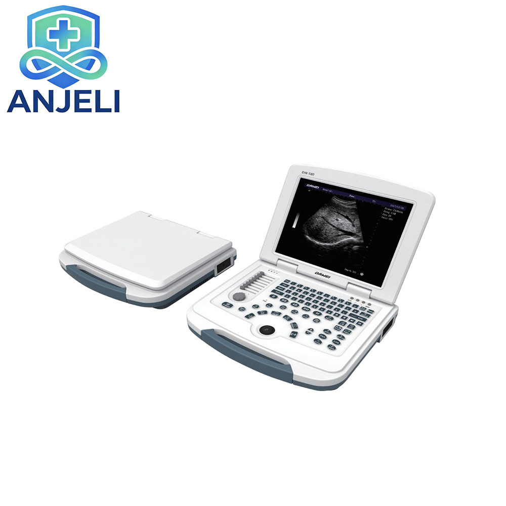 AJL-B580  Medical Laptop B/W Diagnostic Ultrasound Device,AJL-B580  Medical Laptop B/W Diagnostic Ultrasound Device