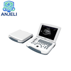 AJL-B580  Medical Laptop B/W Diagnostic Ultrasound Device,AJL-B580  Medical Laptop B/W Diagnostic Ultrasound Device