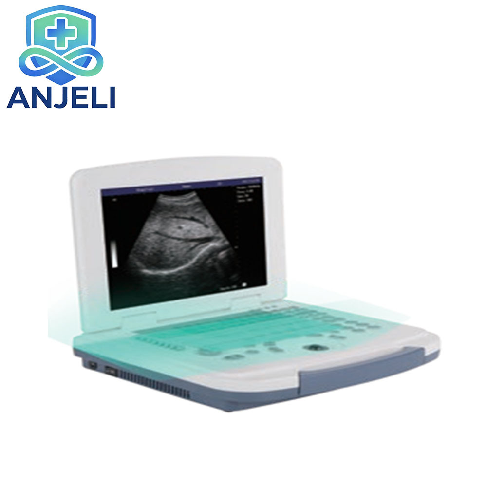 AJL-B580  Medical Laptop B/W Diagnostic Ultrasound Device,AJL-B580  Medical Laptop B/W Diagnostic Ultrasound Device