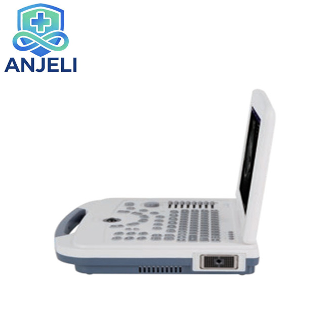 AJL-B580  Medical Laptop B/W Diagnostic Ultrasound Device,AJL-B580  Medical Laptop B/W Diagnostic Ultrasound Device