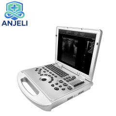 Laptop Full Digital color ultrasonic Diagnostic Apparatus