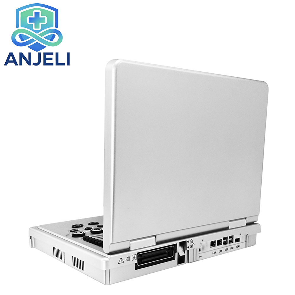 Laptop Full Digital color ultrasonic Diagnostic Apparatus