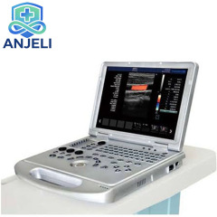 Color Doppler Ultrasound machine