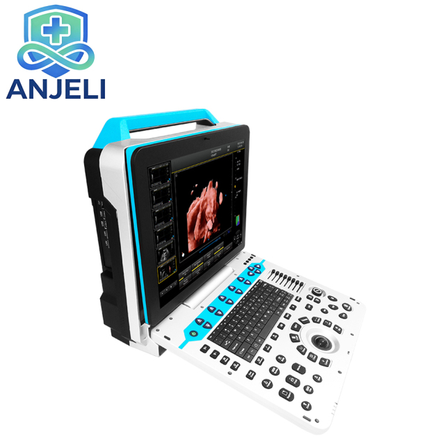 Color Ultrasonic Diagnostic Apparatus