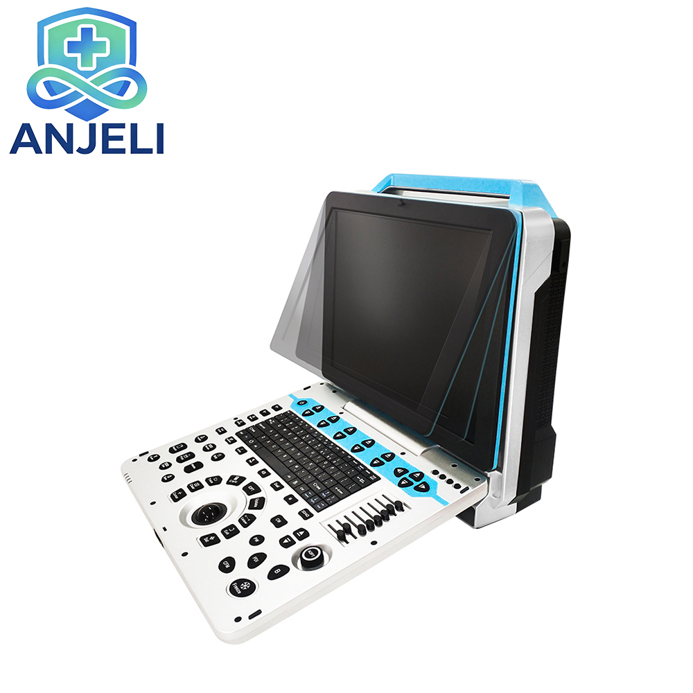 Color Ultrasonic Diagnostic Apparatus