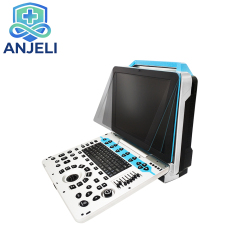 Color Ultrasonic Diagnostic Apparatus