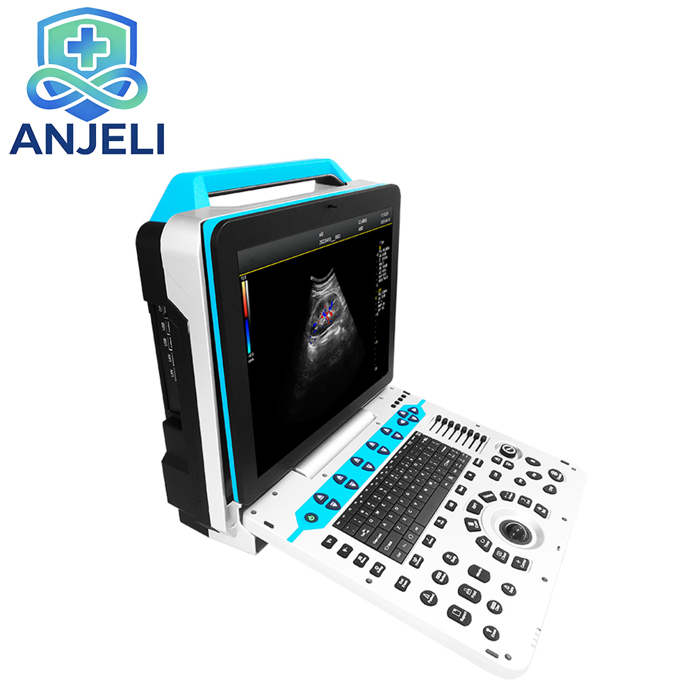 Color Ultrasonic Diagnostic Apparatus