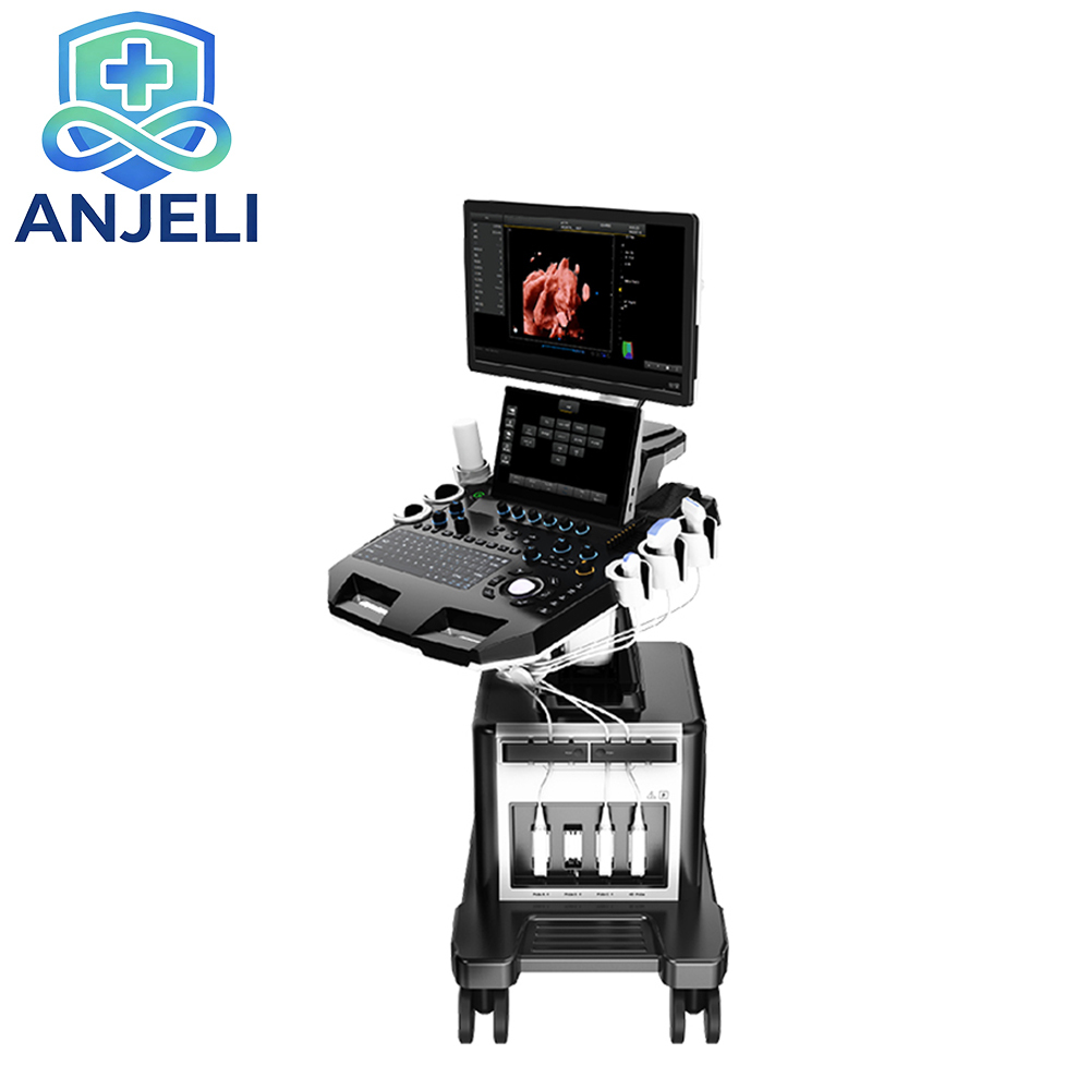 Color Ultrasonic Diagnostic Apparatus