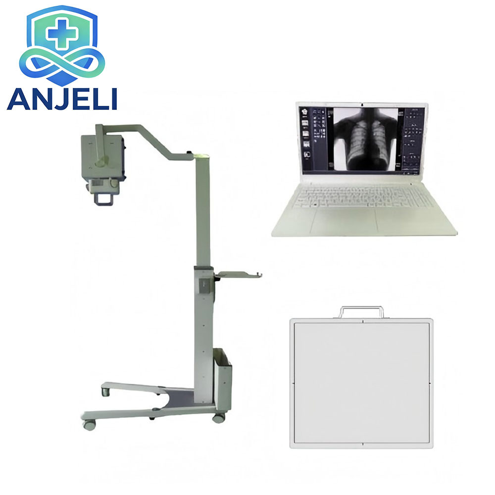 X-ray System,Mobile Digital Radiography X-ray System