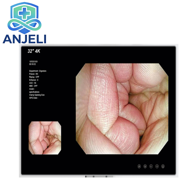 Electronic Flexible Endoscope