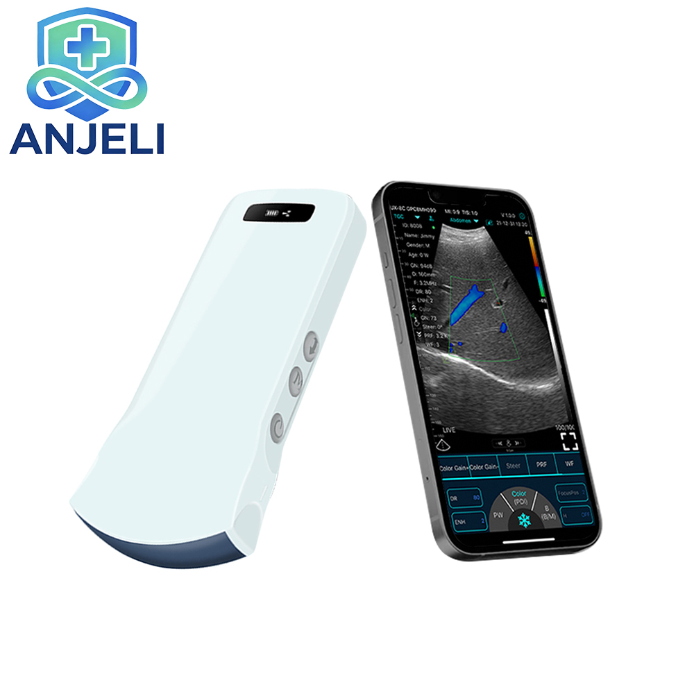 Wireless Convex Color Doppler probe