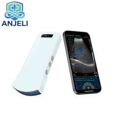 Wireless Convex Color Doppler probe
