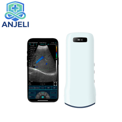 Wireless Convex Color Doppler probe