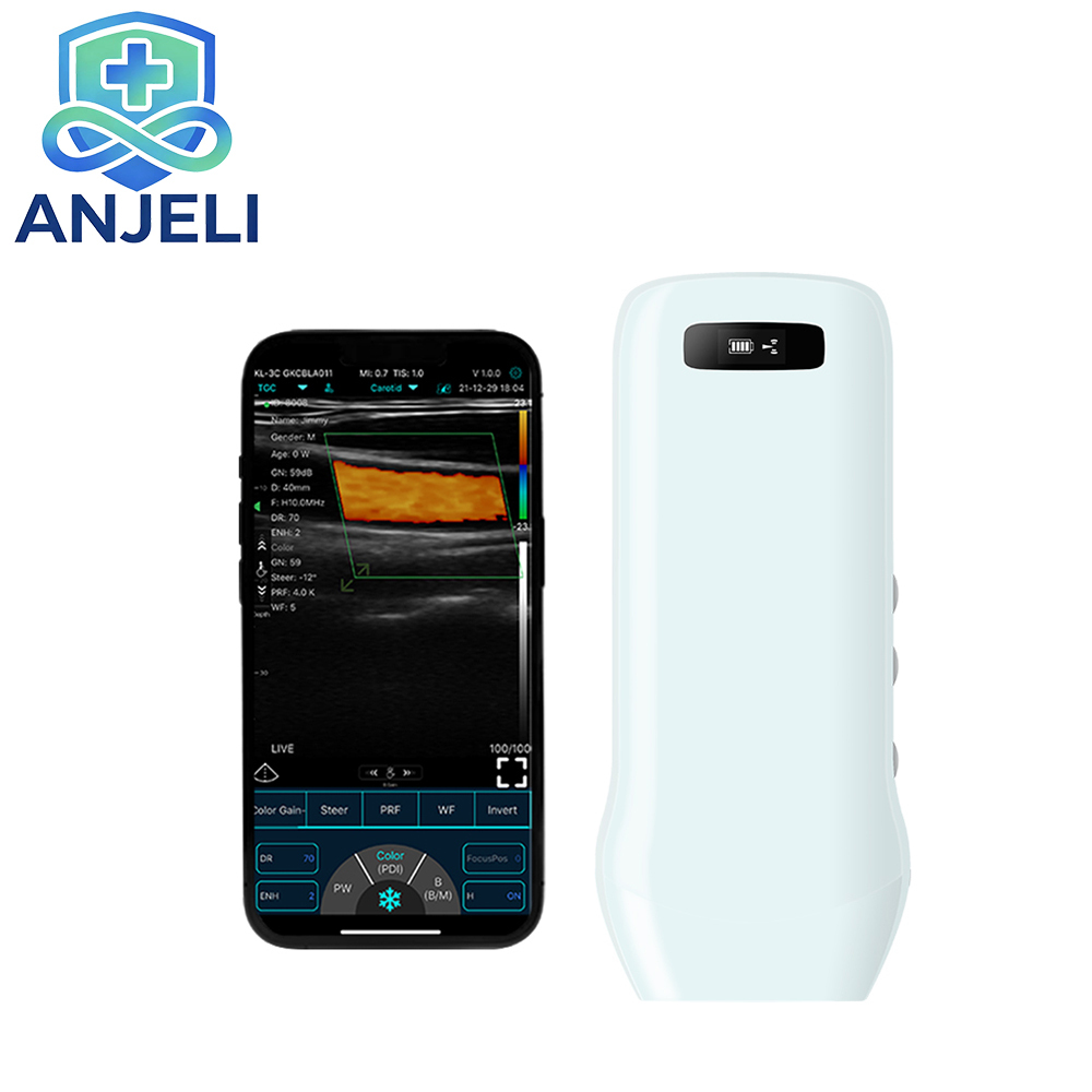  Wireless linear color Doppler ultrasound