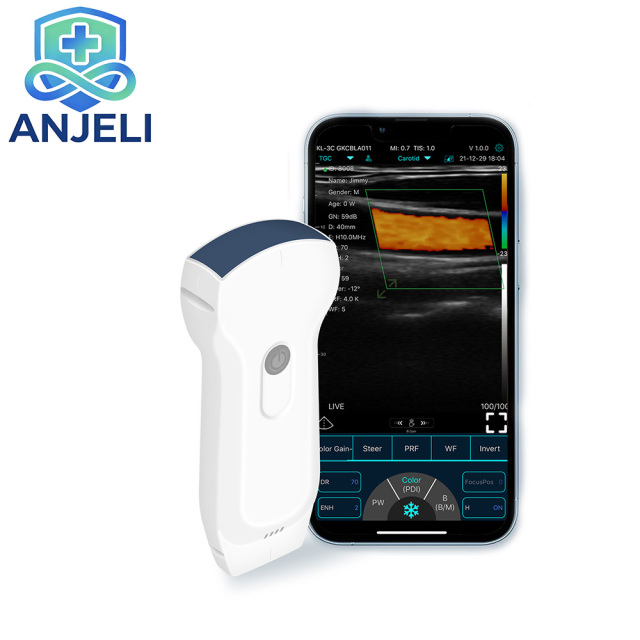Double head Convex Probe +Trans-vaginal Probe