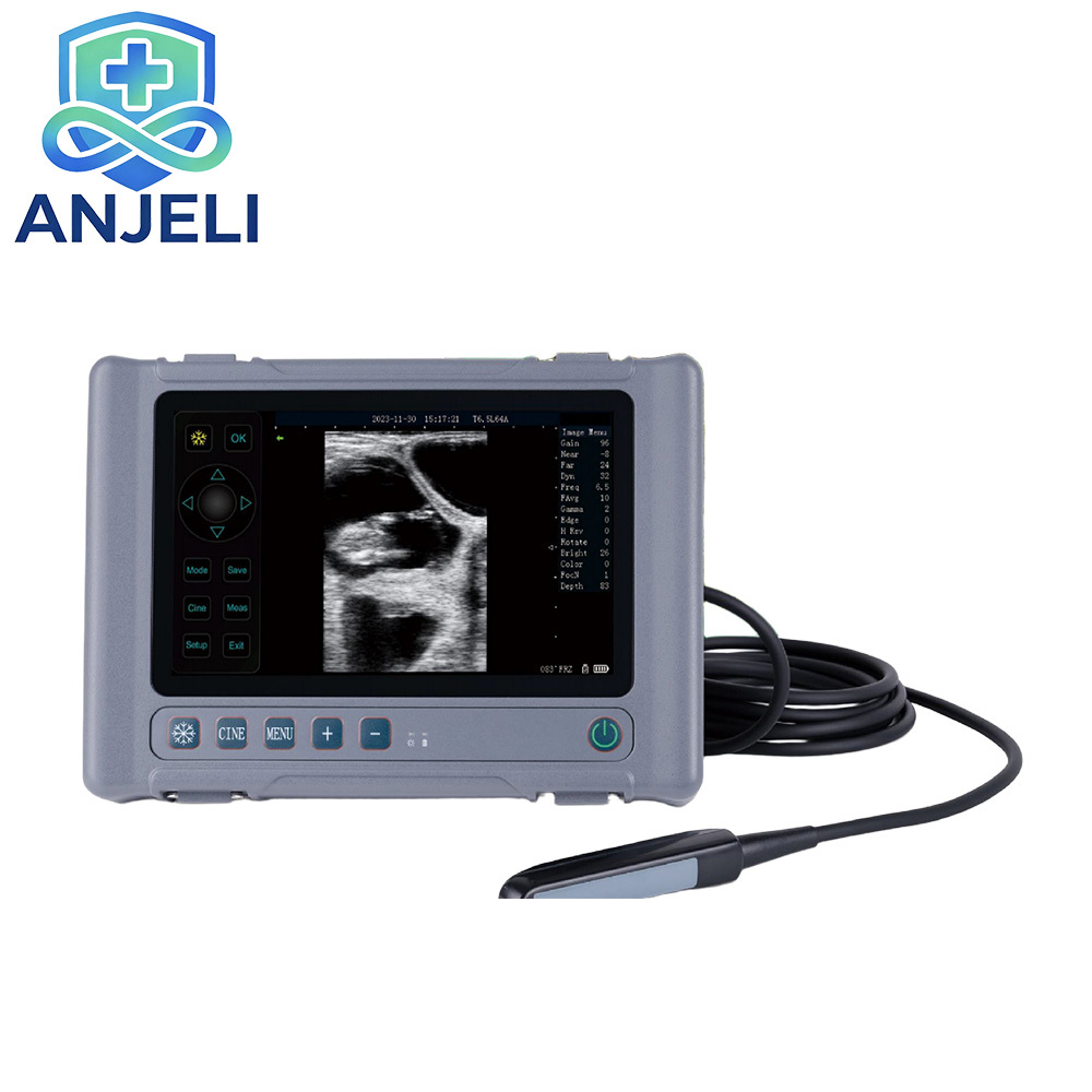 Veterinary Full Digital Ultrasound Diagnostic System