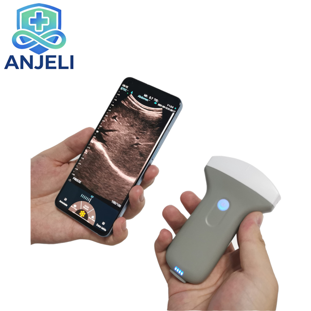 Handheld USBaWiFi UItrasound