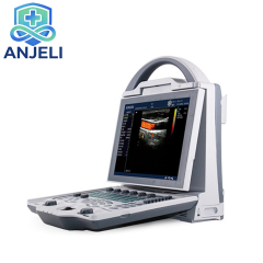 Full Digital Color Doppler Ultrasonic Diagnostic Instrument