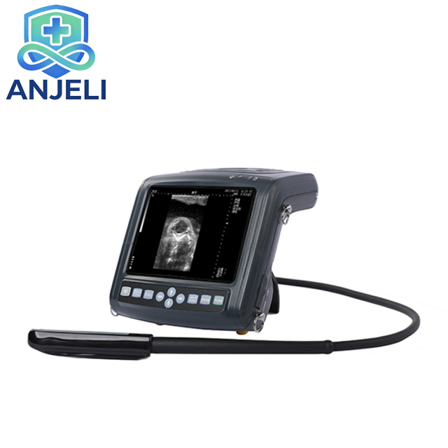 Full Digital Ultrasonic Diagnostic Instruments