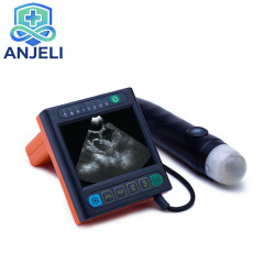 Full Digital Mechanical Sector Scanning Ultrasonic Diagnostic Scanner