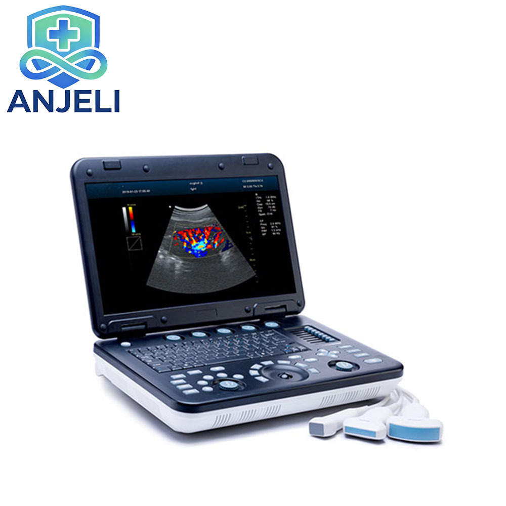 Color Doppler Ultrasound System