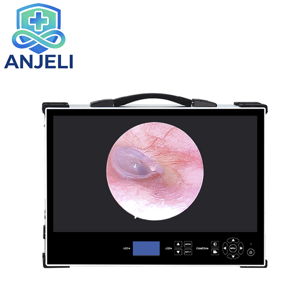 Medical Full HD Endoscopic System, endoscope
