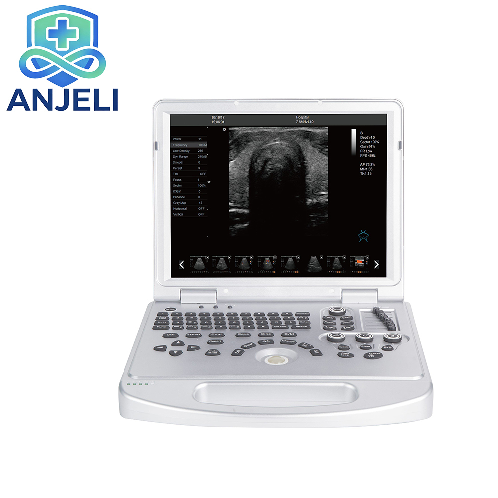 Portable Color Doppler Ultrasound machine