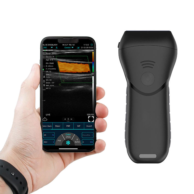 Portable Wireless Ultrasound Probe Convex Array for Diagnostic Imaging  AJLB-10MT,Portable Wireless Ultrasound Probe Convex Array for Diagnostic Imaging  AJLB-10MT